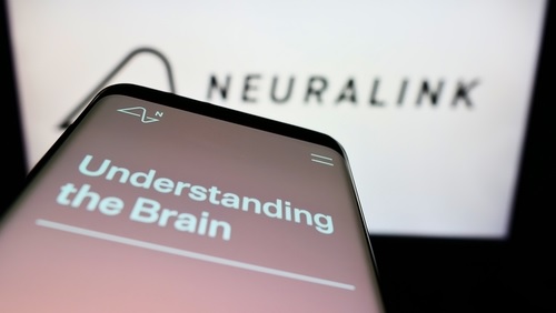 Keamanan Neuralink - WonderVerse Indonesia
