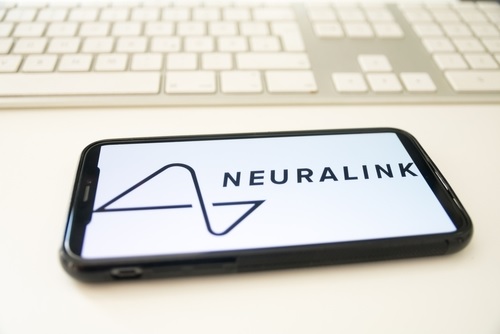 Manfaat Chip Neuralink - WonderVerse Indonesia